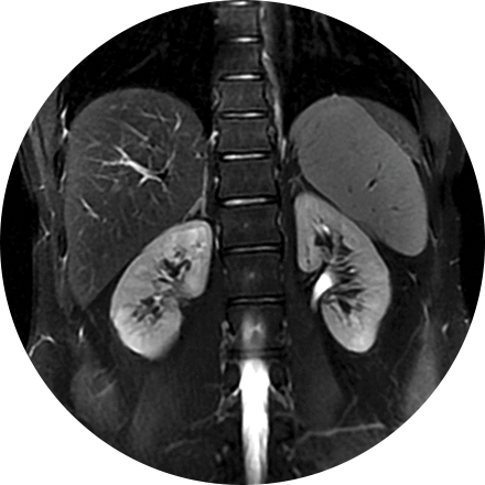 Sacramento Abdominal Imaging