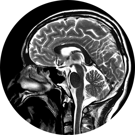 Sacramento Brain & Spine Imaging