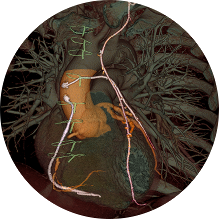 Sacramento Chest Imaging