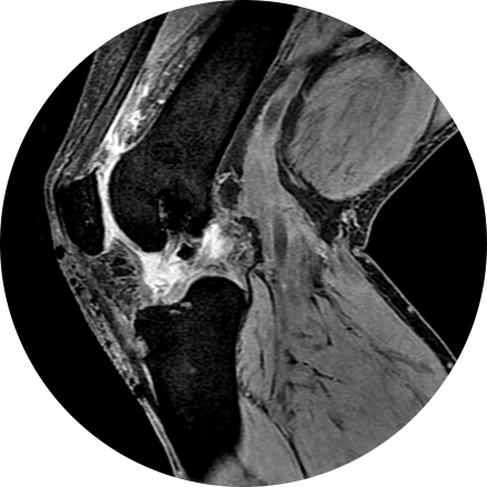 Sacramento Musculoskeletal Imaging