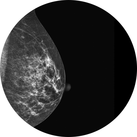 Sacramento Mammography 