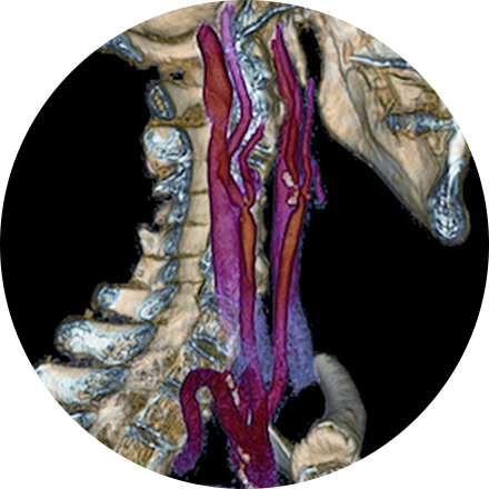 Sacramento Cancer Imaging