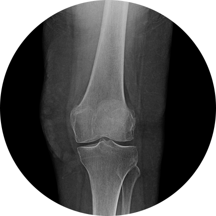 Sacramento Emergency and Trauma Imaging