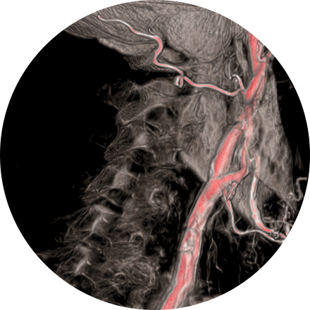 Sacramento Interventional Radiology 