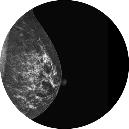 Sacramento Women's Imaging